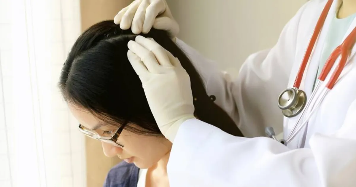 Signs of Scalp Psoriasis and Ways You Can Treat it